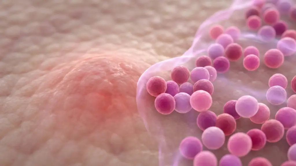 Eixo Intestino-Pele na Acne Adulta: Modulação da Microbiota e o Papel dos Probióticos na Redução da Inflamação Sistêmica